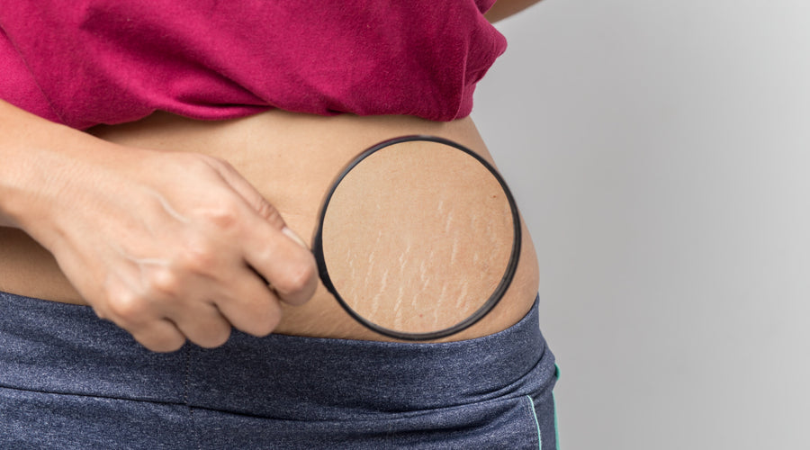 7 Little Ways to Embrace Your Body After Pregnancy